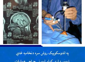 د ترسره شوي بریالي عملیات عکس