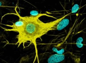 Neural System