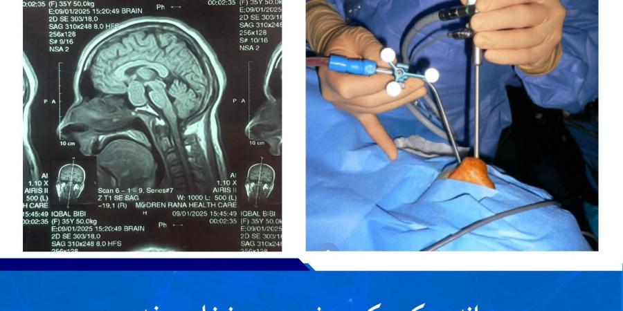 د ترسره شوي بریالي عملیات عکس